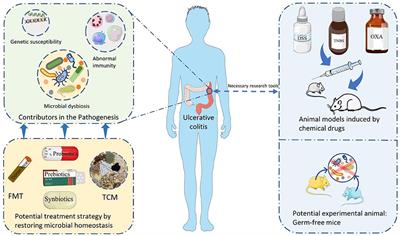The Communication Between Intestinal Microbiota and Ulcerative Colitis: An Exploration of Pathogenesis, Animal Models, and Potential Therapeutic Strategies